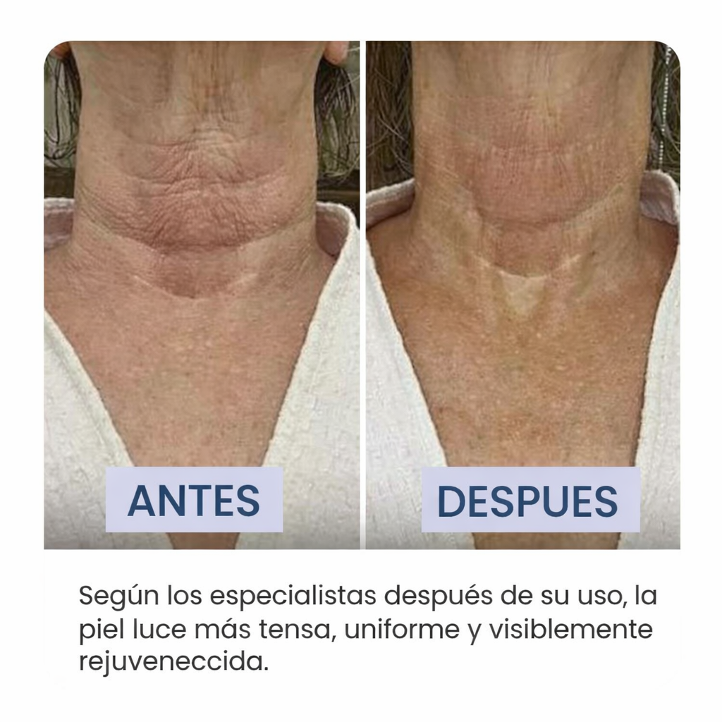 Feature product image